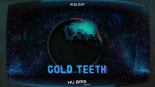 Redlight - Gold Teeth (HU Biss Bootleg)