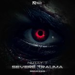 Nutty T - Severe Trauma (Hakka Remix)