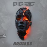 Big RIC - Bruises
